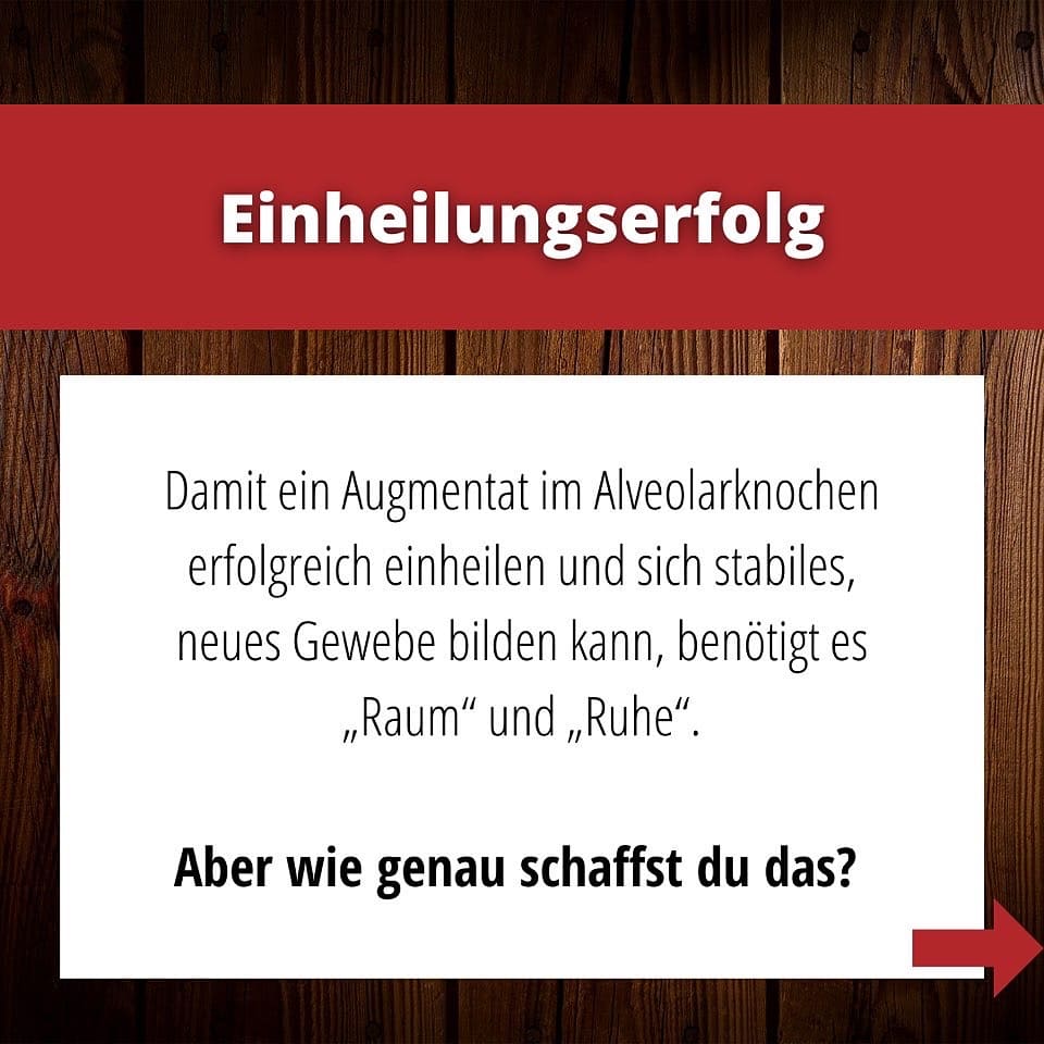 SCHLEE, Umbrella®-Technique-Set Ø 1, 2 SCHLEE, Umbrella®-Technique-Set Ø 1, 2