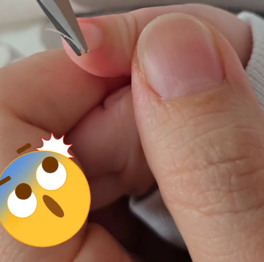 Baby-Nails-MiniaturBild