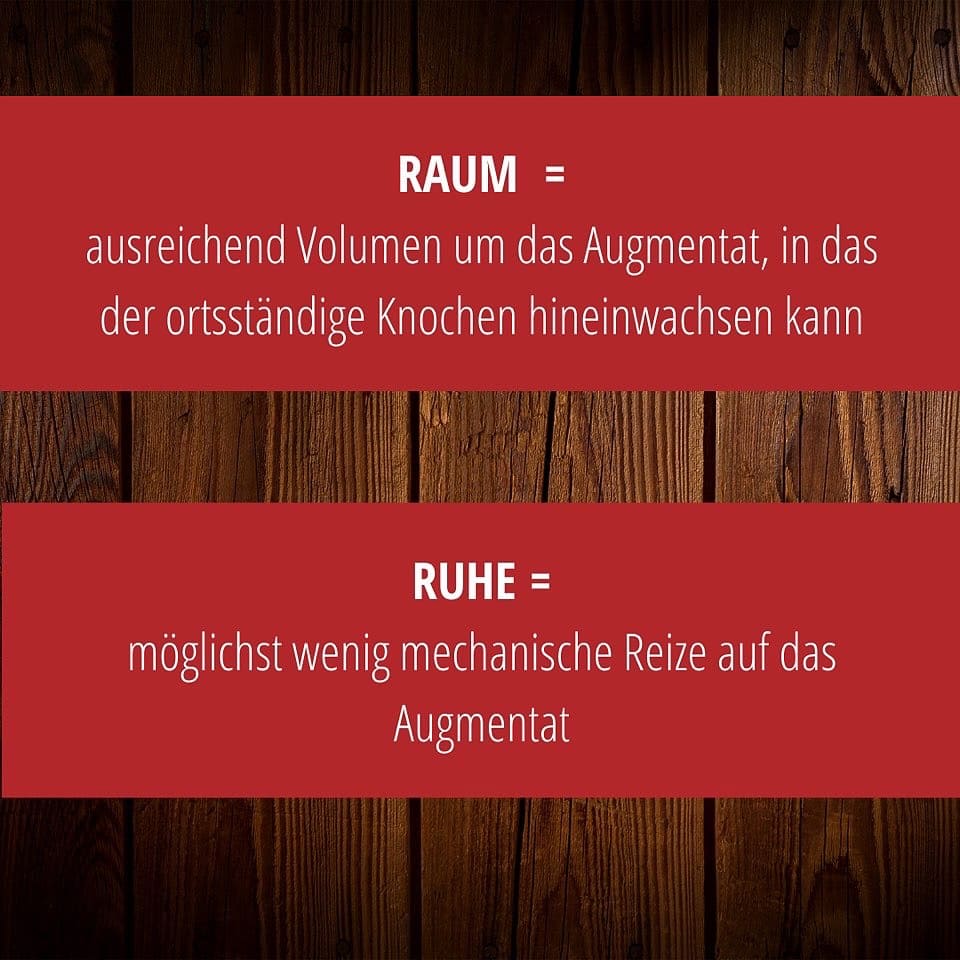 SCHLEE, Umbrella®-Technique-Set Ø 1, 2 SCHLEE, Umbrella®-Technique-Set Ø 1, 2