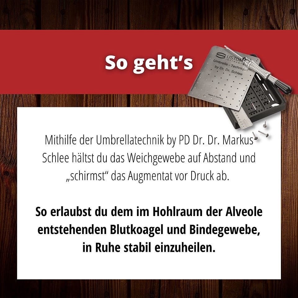 SCHLEE, Umbrella®-Technique-Set Ø 1, 2 SCHLEE, Umbrella®-Technique-Set Ø 1, 2