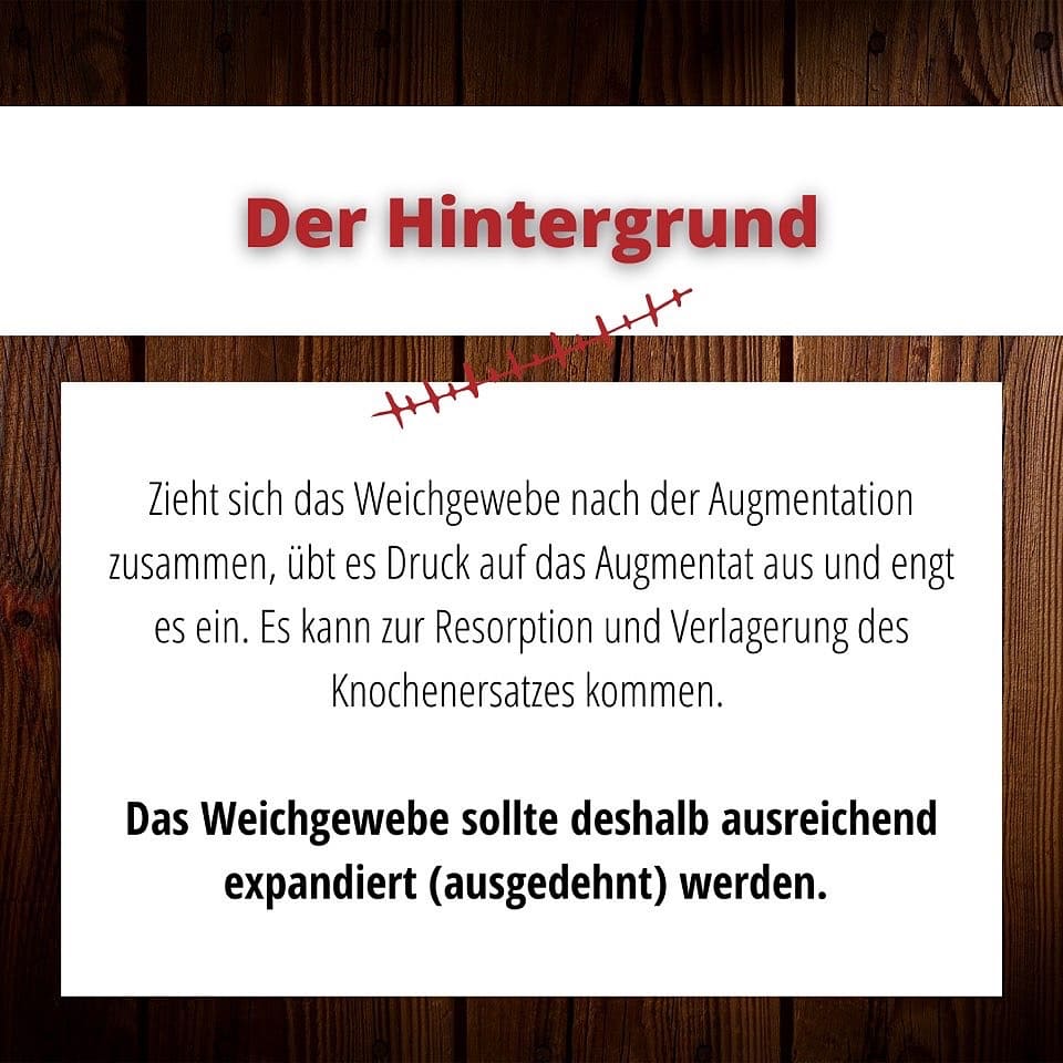 SCHLEE, Umbrella®-Technique-Set Ø 1, 2 SCHLEE, Umbrella®-Technique-Set Ø 1, 2